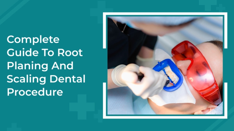 Complete Guide To Root Planning And Scaling Dental Procedure