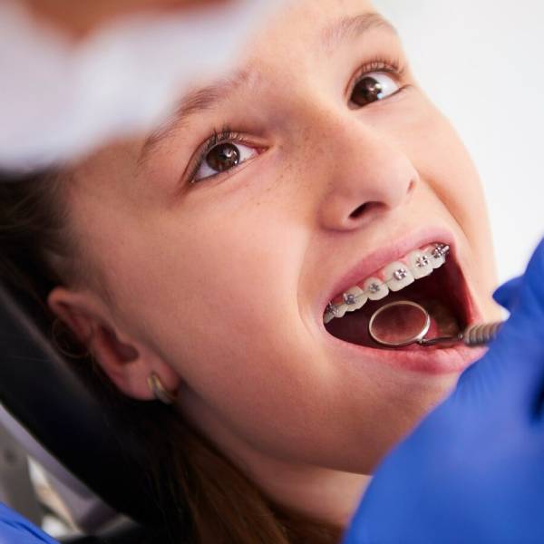 Orthodontic Treatment