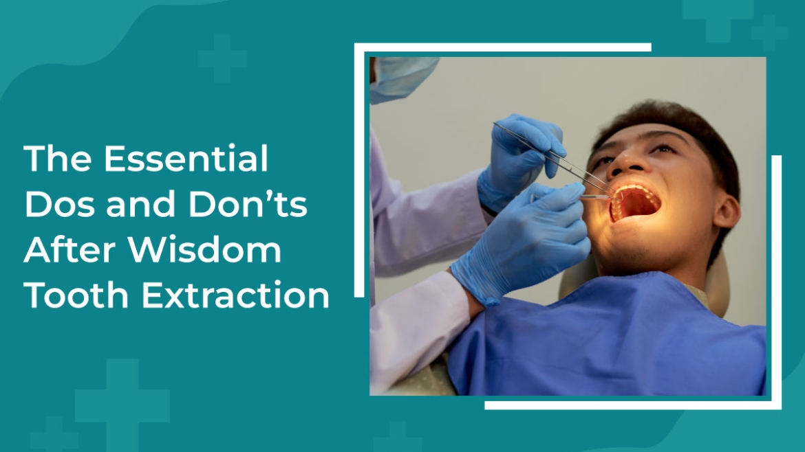 The Essential Dos and Don’ts After Wisdom Tooth Extraction