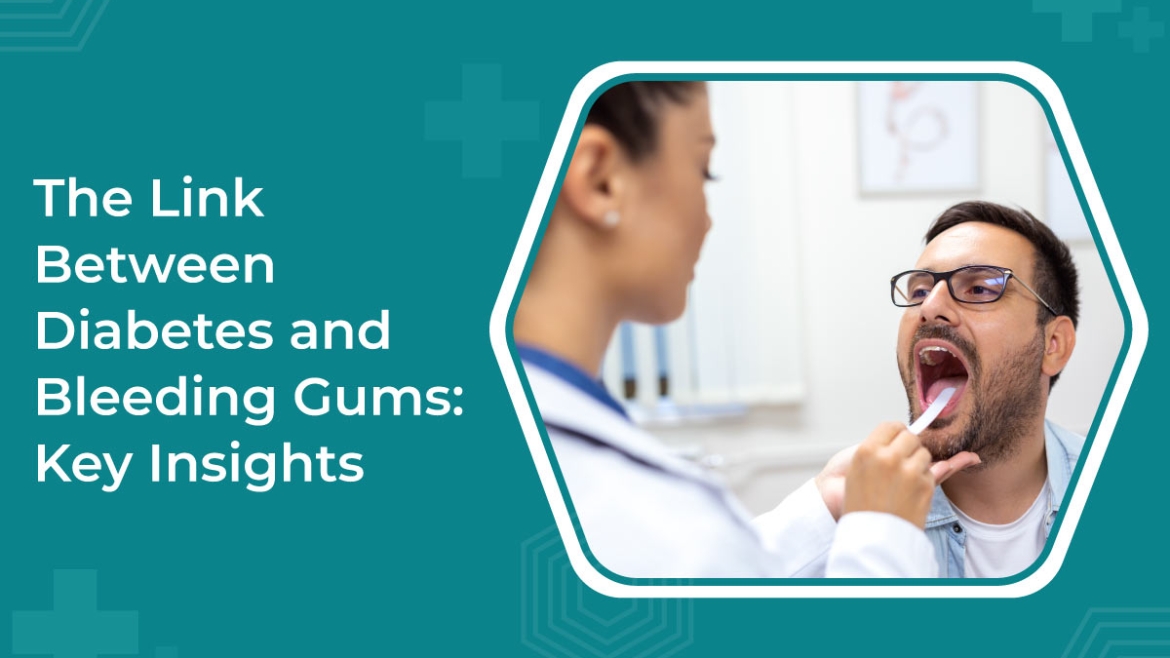 The Link Between Diabetes and Bleeding Gums: Key Insights