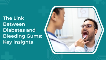 The Link Between Diabetes and Bleeding Gums: Key Insights