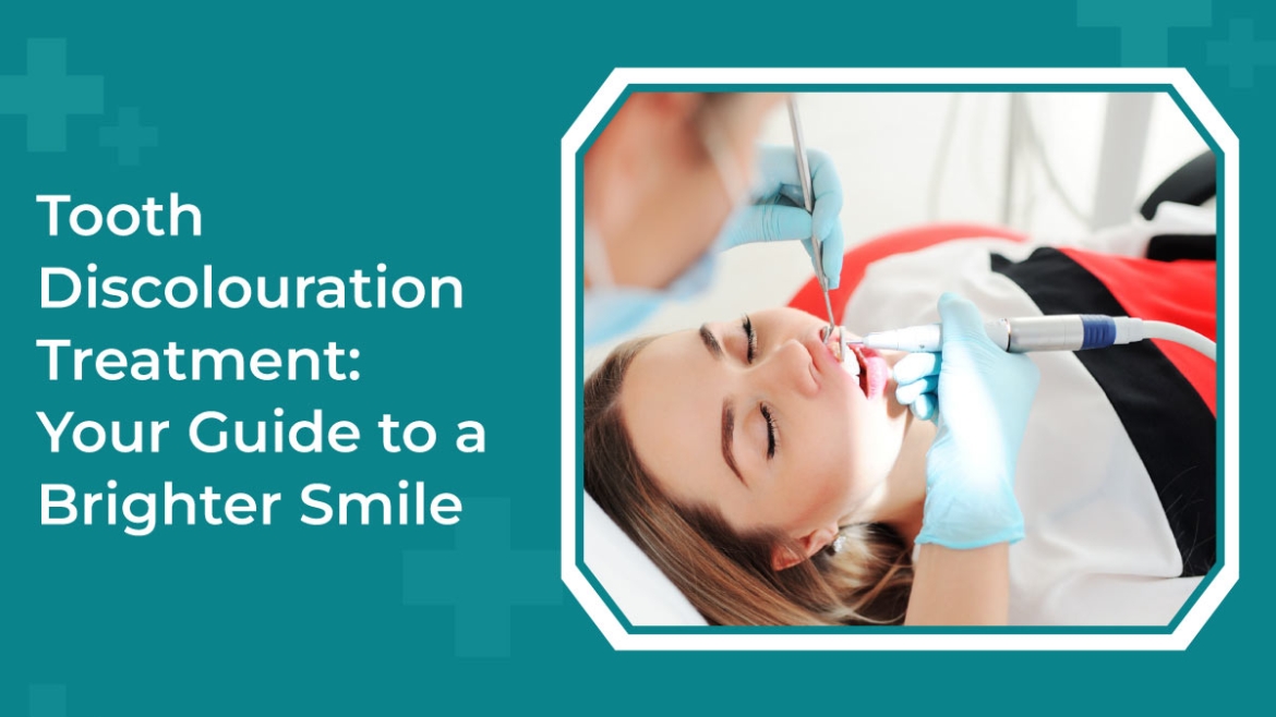 Tooth Discolouration Treatment: Your Guide to a Brighter Smile